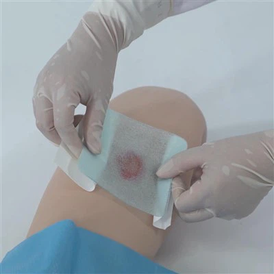 PROPRIETÀ DELLA CARE MIGLIE IL PROPRIETÀ DELLA Ferita di idrogel alimitato.