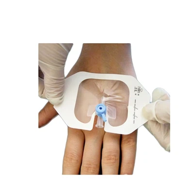 6*7cm i . v . condimento di cannula con u port