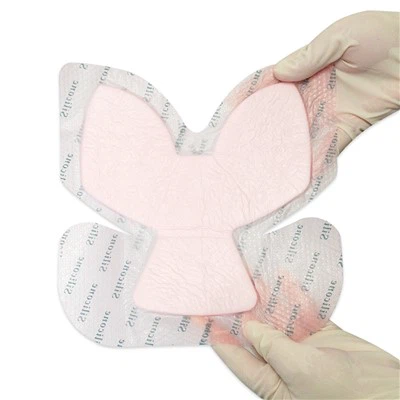 Medicazione in schiuma in silicone allineato medicazione idrocellulare adesiva per tallone